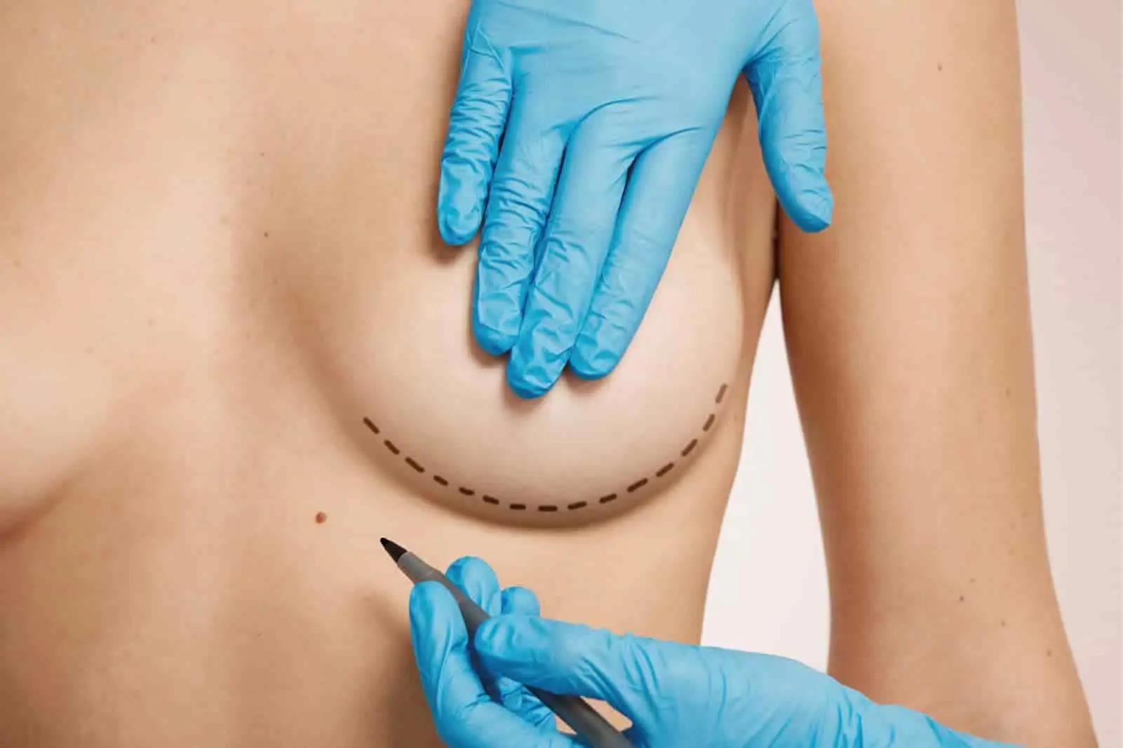 chirurgia estetica copertina operazioni al seno