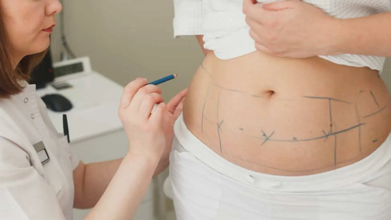 copertina liposcultura