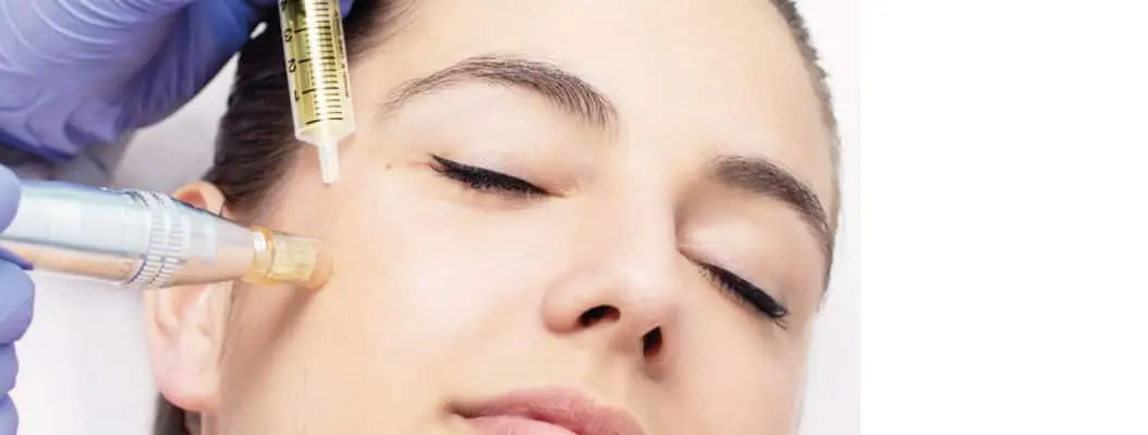 copertina mesoterapia al viso